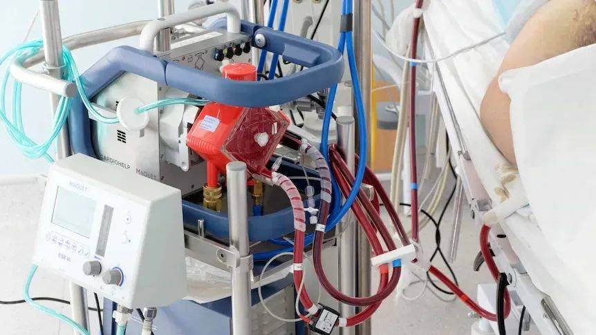 深度 ECMO医疗器械行业市场分析报告
